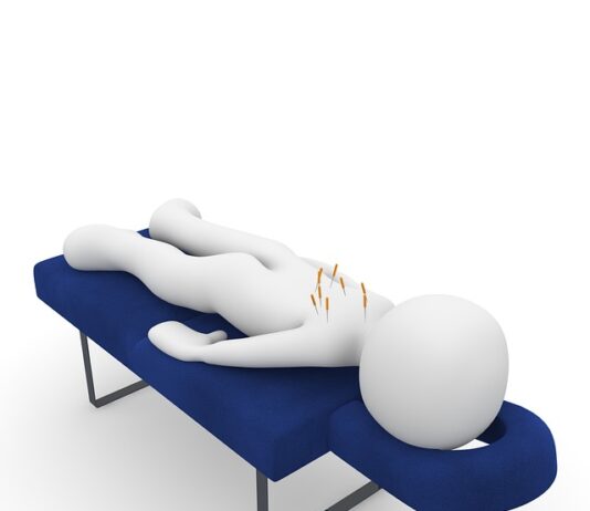 Czy akupunktura pomaga na bóle kręgosłupa?